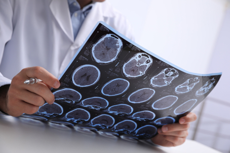 Doctor reviewing brain scans