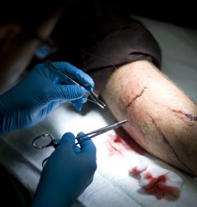 1090105_stitching_together_a_wound_1.jpg